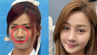 樂天女孩突開刀　醫：內部受傷嚴重