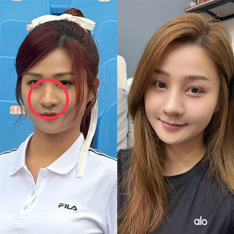 左圖為二月拍廣告畫面,右圖為小紫術後照片。(圖/樂天桃猿提供)