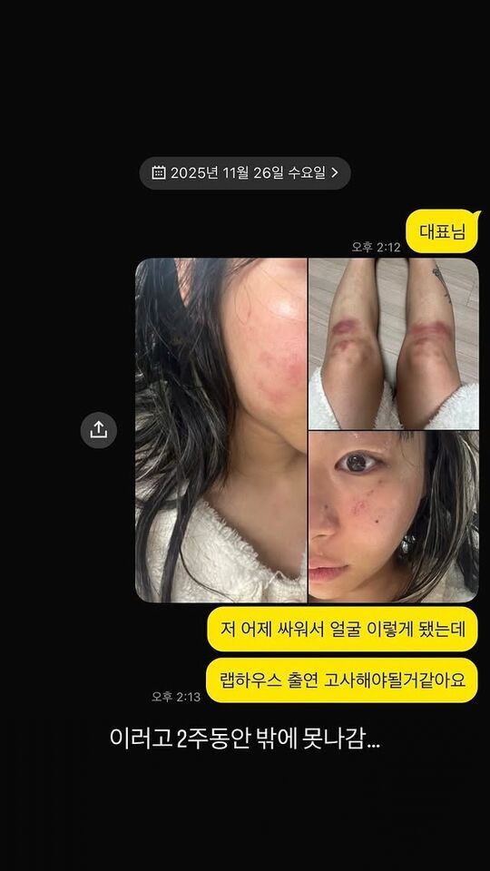 Jvcki Wai公開與公司代表的聊天紀錄,指控前男友施暴。(圖/翻攝自Instagram/jvckiwai)