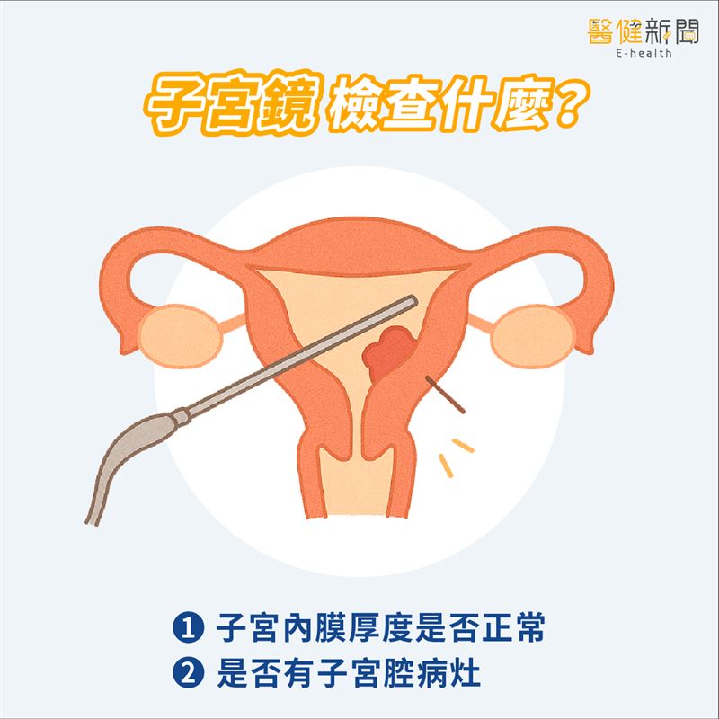 為什麼要做子宮鏡檢查?子宮鏡檢查什麼?醫揭「提升著床率」關鍵!(圖/醫健新聞網提供)