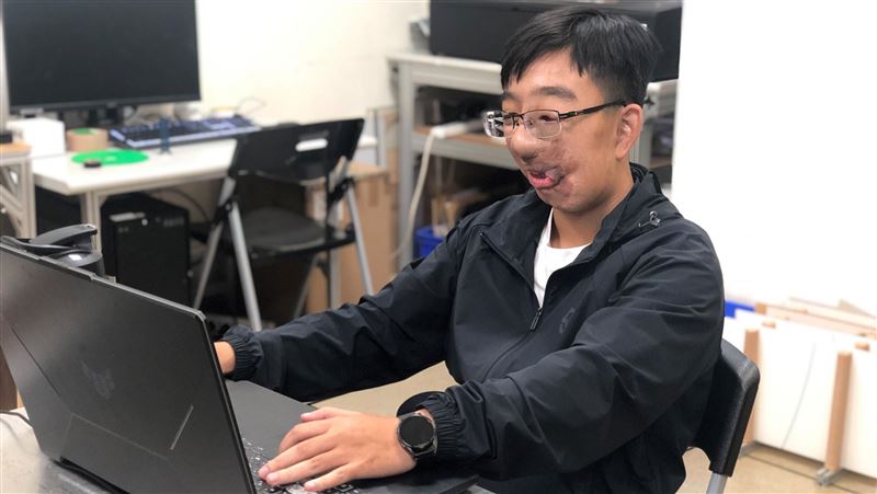 患神經纖維瘤遭霸凌！她甩陰霾奪雙金