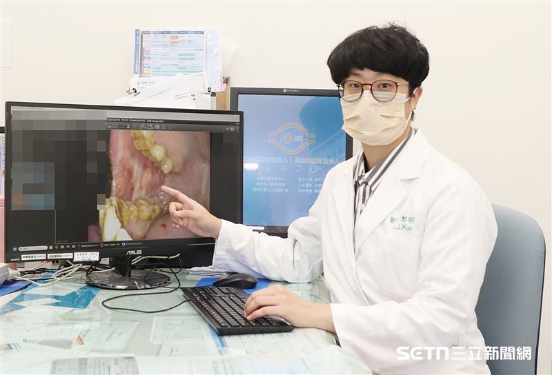 針對頭頸癌術後的重建挑戰,仁愛長庚合作聯盟醫院整形外科郭曉芮醫師特別指出,頭頸癌重建的關鍵在於將設計好的游離皮瓣像量身訂做的拼圖一樣放回去,確保病人治療及生活不中斷。重點在於,重建的意義不只是把缺損「補起來」,而是必須讓病人能吞嚥、能發音,最終目標是讓患者能恢復社交與自理能力,重拾生活尊嚴。(圖/院方提供)