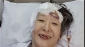 尹石花,腦瘤,手術,門牙,化療,見證,伊甸教會