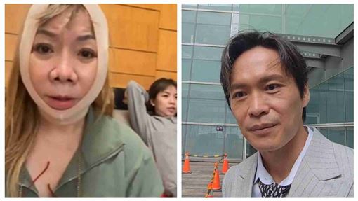 64歲萁媽突開刀　黃鐙輝鬆口背後原因