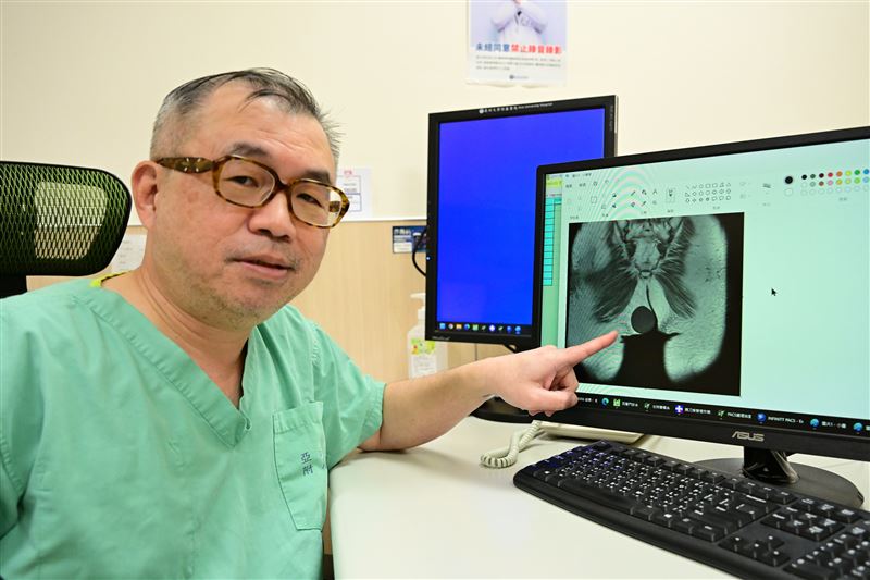 醫師鄭旭棠指出，脂肪瘤是一種十分常見的良性腫瘤，源自脂肪細胞異常增生，可能出現在身體任何有脂肪的地方。（圖／亞大附醫提供）