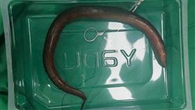 一條長達30公分的活鱔魚，從肛門鑽進男子的腸道。（翻攝自微博）