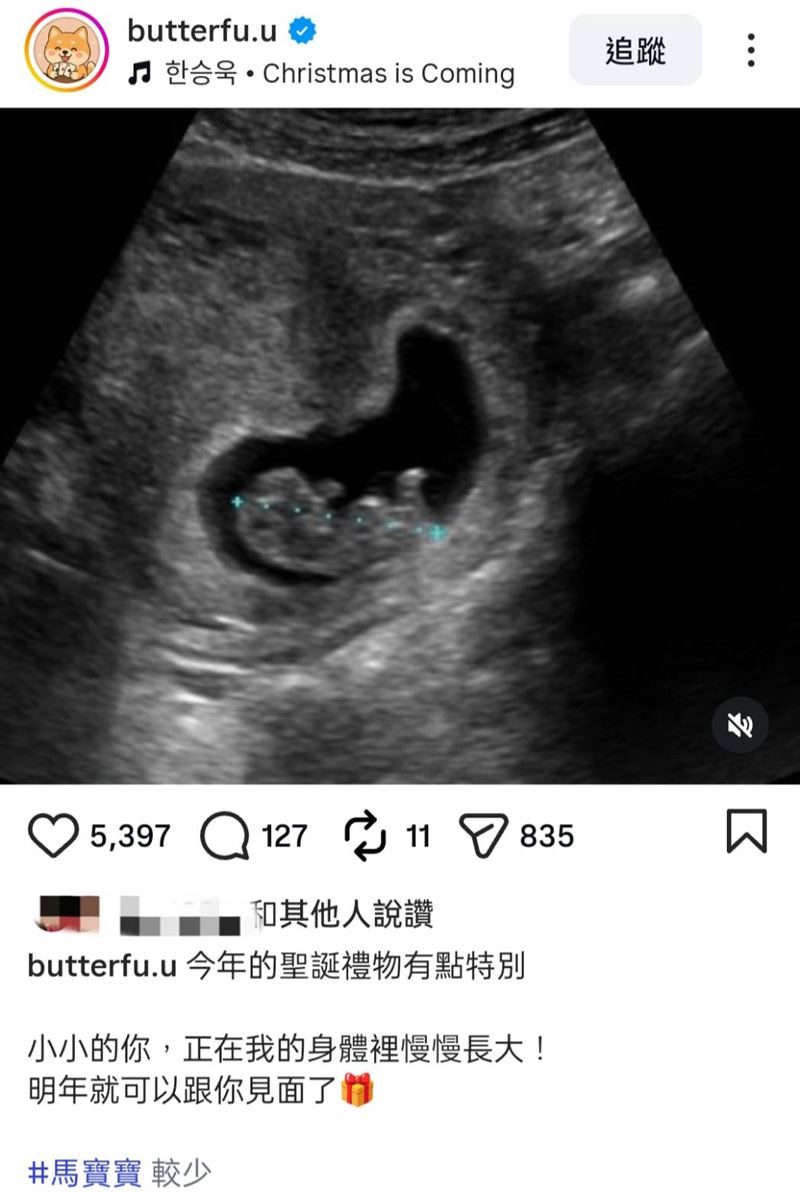 蝴蝶兒突然曬出超音波照。（圖／翻攝自IG）