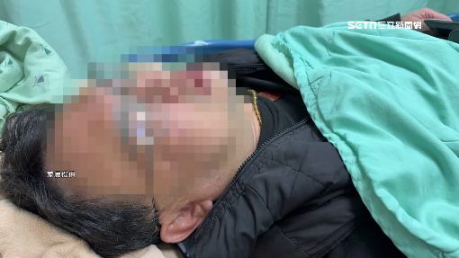 獨／控學生霸凌、攻擊　國小師氣昏送醫