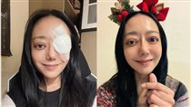 三度手術恐失明！三金女星最新近照曝