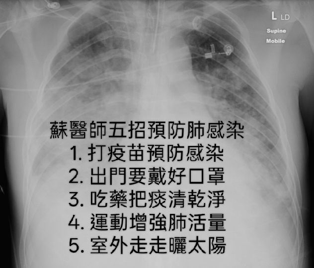 蘇一峰表示，慢性疾病患者及老年人特別容易感染肺炎。（圖／翻攝自蘇一峰臉書）