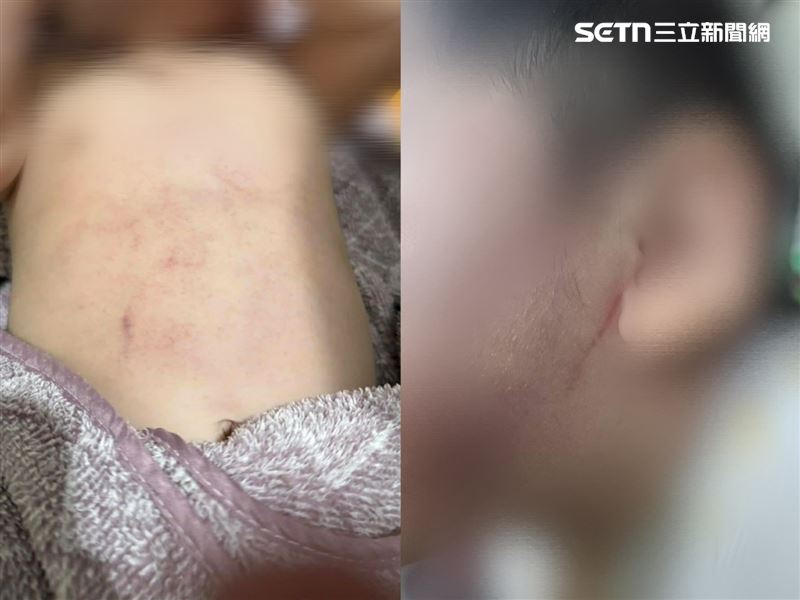 台南麻豆區爆出保母虐嬰童事件，孩子身上的傷痕讓家長看了心碎。（圖／翻攝畫面）