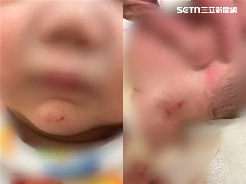 嬰童臉部、耳朵出現紅腫傷痕，下巴還有濺血結痂傷口。（圖／翻攝畫面）