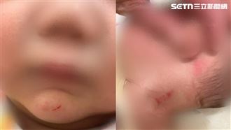 11月嬰躺加護虐照碎心　惡保母超收6幼童