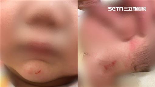 11月嬰躺加護虐照碎心　惡保母超收6幼童