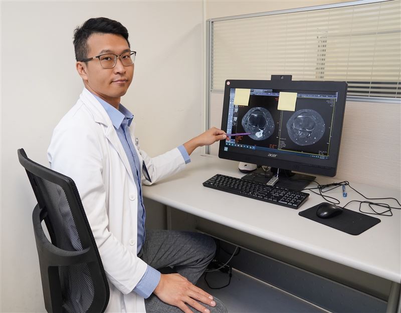 陳威仁表示，若囊腫持續變大，除了影響蹲跪、走路，嚴重時甚至會壓迫血管及神經，引起麻木，建議手術治療。 （圖／中國醫藥大學新竹附設醫院提供）