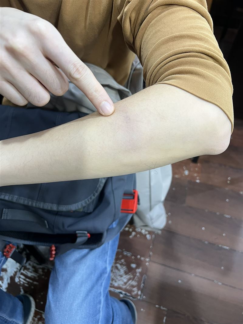 被害人手臂遭薛男攻擊受傷。（圖／翻攝畫面）