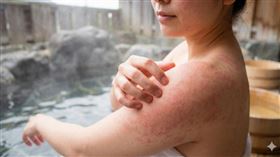 泡湯危「肌」重重！醫提不傷肌「5建議」（圖／醫健新聞網提供） 