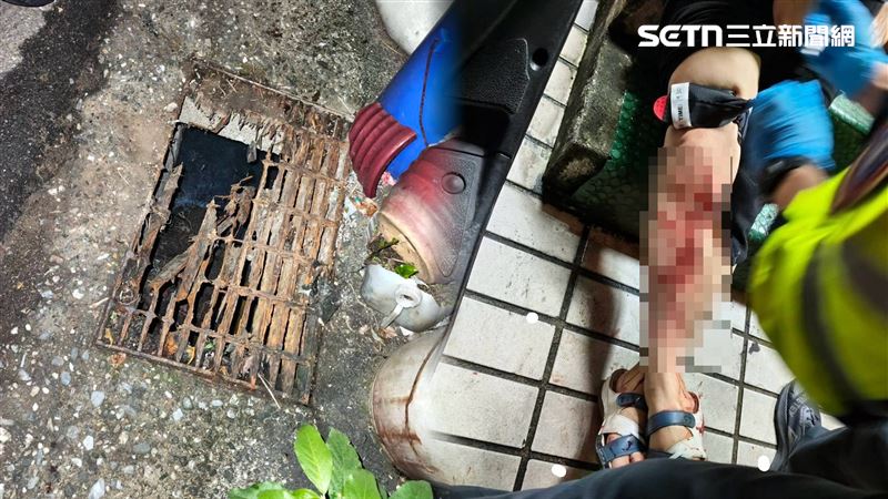 基隆水溝蓋鏽蝕，林女踩空右腿遭劃傷，鮮血直流送醫縫30多針。（圖／翻攝畫面）