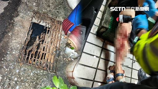 基隆水溝蓋鏽蝕！女踩空右腿劃傷噴血縫針