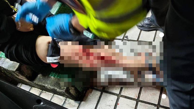 基隆水溝蓋鏽蝕，林女踩空右腿遭劃傷，鮮血直流送醫縫30多針。（圖／翻攝畫面）