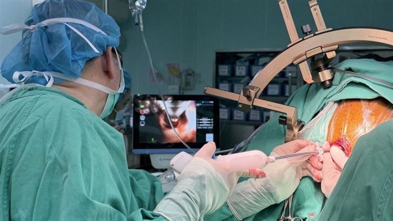 「1類息肉」潛伏20年！他拖6月慘變大腸癌