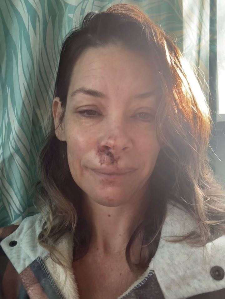 伊凡潔琳莉莉當初受傷相當嚴重，面部直直撞上岩石。（圖／翻攝自IG @evangelinelillyofficial）