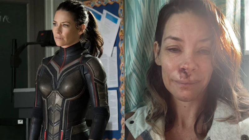 黃蜂女頭撞岩石嚴重腦震盪　她揭背後真相