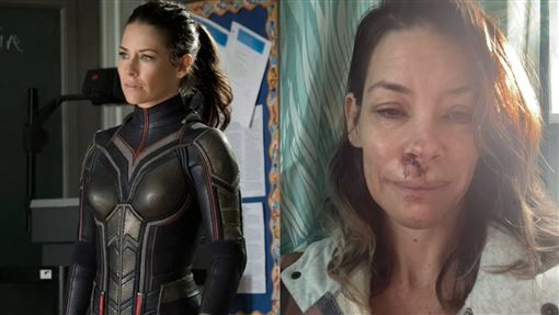 黃蜂女頭撞岩石嚴重腦震盪　她揭背後真相