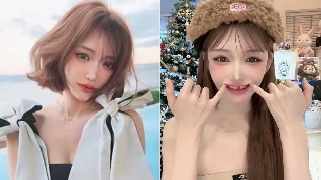 明日花綺羅斷牙真相曝！認整形麻醉險喪命