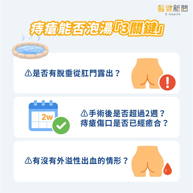 有痔瘡可泡湯？醫提「3關鍵」與「4步驟」。（圖／醫健新聞網提供）
