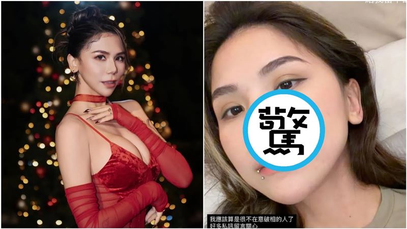 蕾菈（Lyla）臉蛋留下愛貓後空翻「戰績」。（翻攝IG@la.112814）