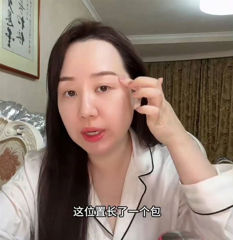 關凌用刺破兒子臉上的腫包。（圖／翻攝自微博）