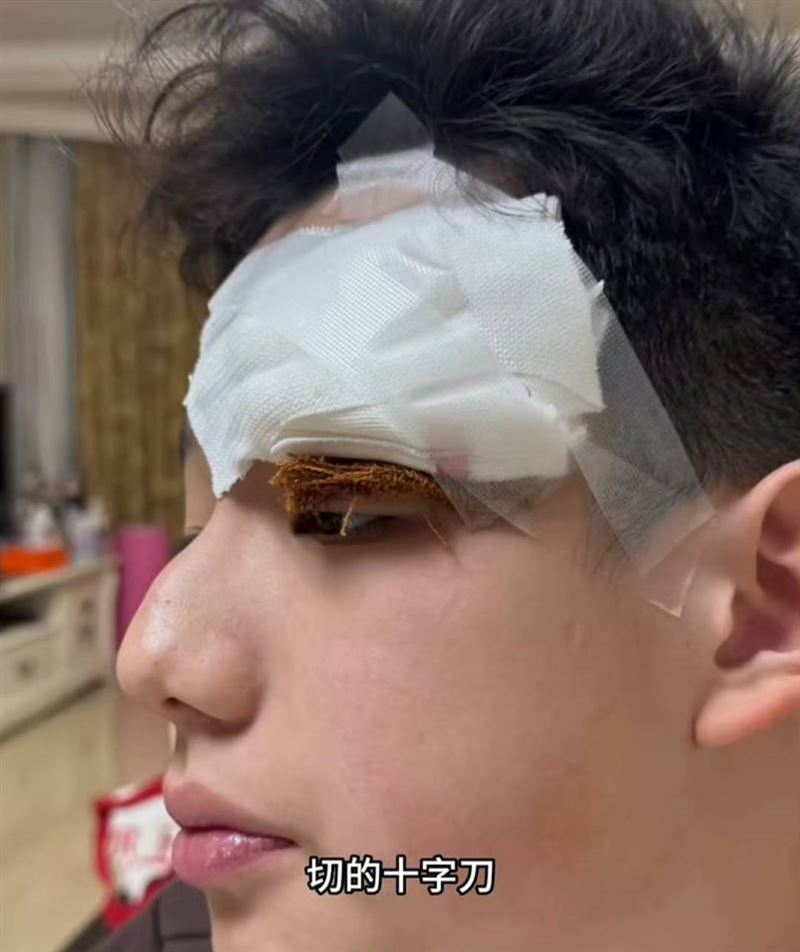 關凌兒子最終送醫手術。（圖／翻攝自微博）