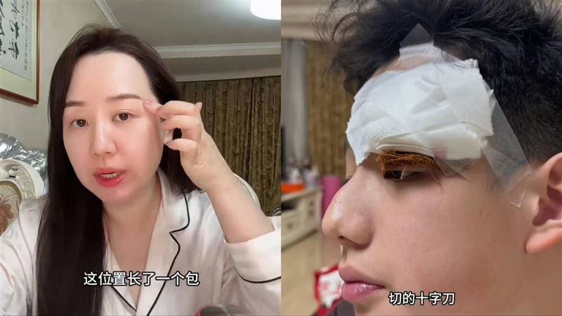 女星硬擠兒臉上痘害感染送醫　自責道歉了