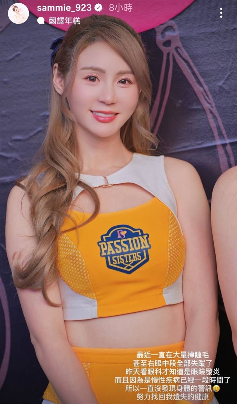 短今透露近期大量掉睫毛，一檢查才發現是眼瞼發炎。（圖／翻攝自IG）