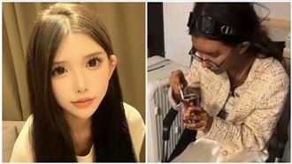 網紅柬國報平安照　他爆：牙被拔光才吃粥