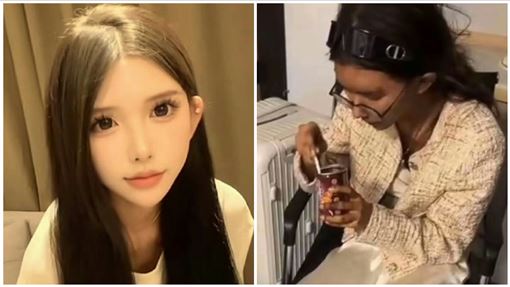 網紅柬國報平安照　他爆：牙被拔光才吃粥