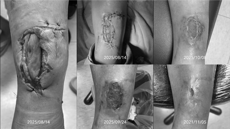 深層創傷有解！助患者創造自癒奇蹟