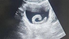 大陸河南省鄭州市近日發生一起離譜卻值得警惕的醫療事件。（圖／翻攝自微博）