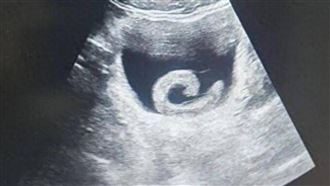 大陸河南省鄭州市近日發生一起離譜卻值得警惕的醫療事件。（圖／翻攝自微博）