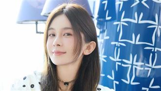 35歲女星認整形　自嘲：自行車換成跑車