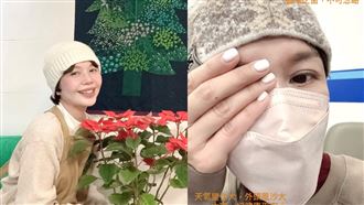 金鐘女星出事了！左眼受傷「起床流膿」