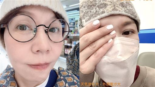 眼睛受傷流膿！金鐘女星再曬圖喊：被嚇到