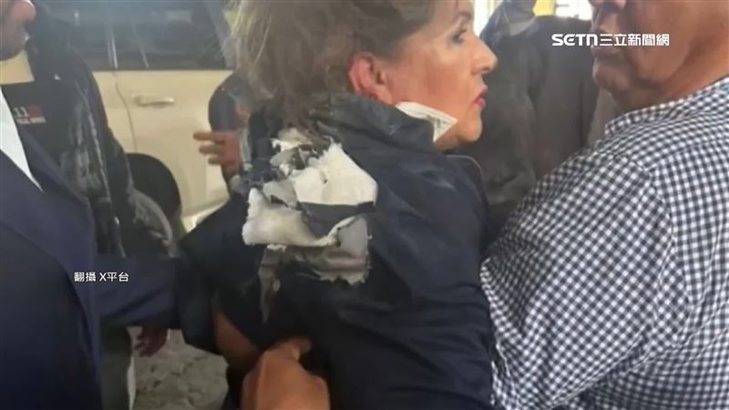 所幸只有衣服破一個洞，人並無大礙