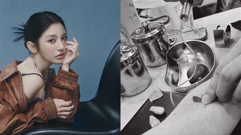 蔡瑞雪病倒急就醫　扎針照流出連喊：好痛