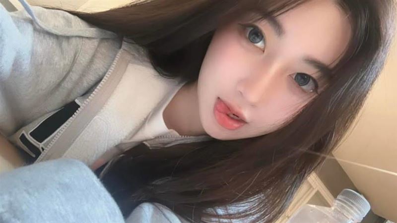 一粒驚傳地中海禿 本尊鬆口認了關鍵主因