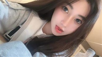 一粒驚傳地中海禿　本尊鬆口認了關鍵主因