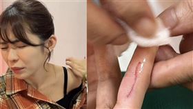 林萱瑜驚傳拍戲受傷。（圖／翻攝自臉書）