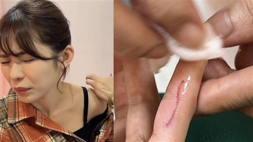 林萱瑜拍《百味》受傷！鮮血直流驚傳暈倒