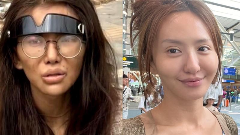 撞臉柬埔寨斷腿中國網紅!薔薔不忍出手了